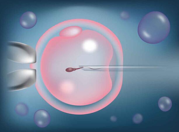試管嬰兒移植后幾天著床 試管嬰兒移植后幾天著床
