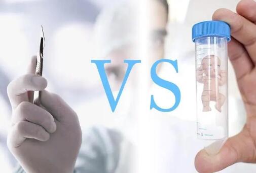 人工授精和試管嬰兒的區(qū)別 人工授精和試管嬰兒的區(qū)別