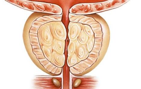 男性發生膀胱炎怎么辦  有哪些治療方法