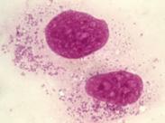 地方性斑疹傷寒