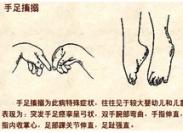 維生素D缺乏性手足抽搐癥