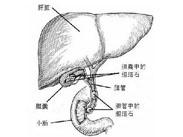 膽囊膽固醇沉著癥