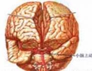 小兒出血性休克和腦病綜合征