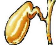 急性梗阻性化膿性膽管炎