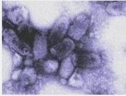 新生兒柯薩奇病毒B感染