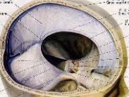 上矢狀竇血栓性靜脈炎