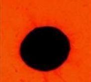 己糖激酶缺乏癥