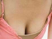 成人型女性乳房肥大癥