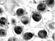 長Q-T間期綜合征